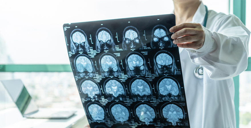 Living with Nerve Conditions: Effective Management