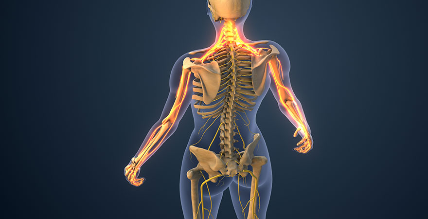 Why Neck Pain Often Appears Days After a Car Accident